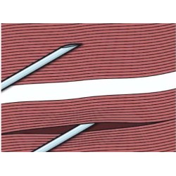 Aiguille Spinale BD YALE noire 22G 0.7 X90 mm boite de 25