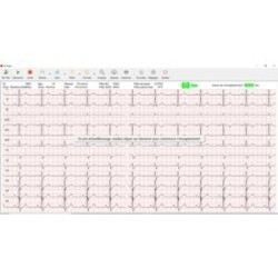 LOGICIEL POUR CARDIOMATE 3,6,12 & PC-ECG - Spengler