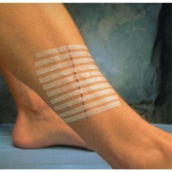 Steri-Strip Bandelette Suture Stérile 3M Rouge 75x6 MM
